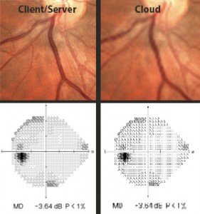 Ophthalmology EMR Imaging Comparison